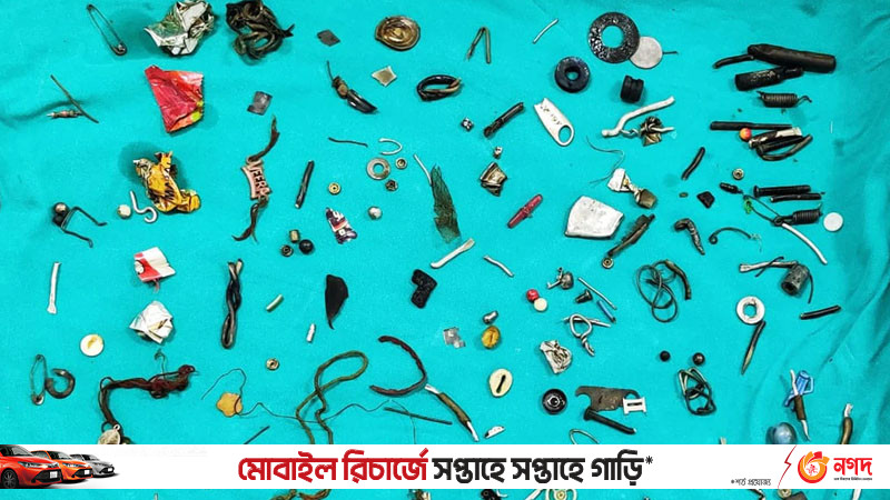 তীব্র পেট ব্যাথা নিয়ে হাসপাতালে, বেরিয়ে এলো ১০০ ধাতব বস্তু